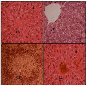 Image for - Effect of 6-shogaol and 6-gingerol on Diclofenac Sodium Induced Liver Injury