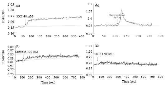 Image for - The Characteristics of Contractions to Hyperosmolar Stress in Rat Aorta