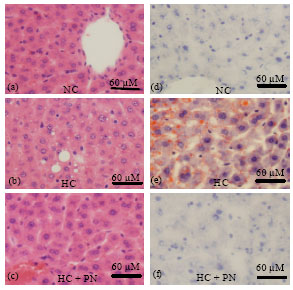 Image for - Pleurotus nebrodensis Ameliorates Atherogenic Lipid and Histological Function in Hypercholesterolemic Rats