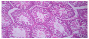 Image for - Biochemical and Histological Responses of Hepatotoxic Rats Fed Musa paradisiaca L. Supplemented Diet