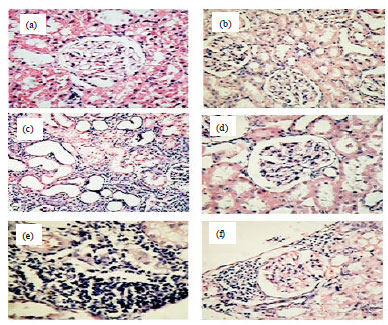 Image for - Renoprotective Effects of Reconstructed Composition of Trigonella foenum-graecum L. Seeds in Animal Model of Diabetic Nephropathy with and without Renal Ischemia Reperfusion in Rats