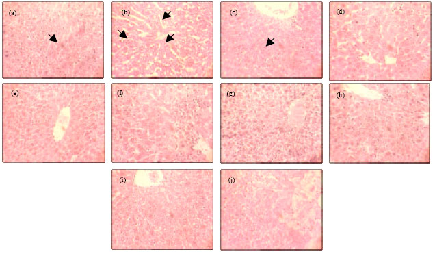 Image for - Protective Activity of Fumaria vaillantii Extract and Monomethyl 
  Fumarate on Acetaminophen Induced Hepatotoxicity in Mice