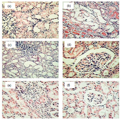 Image for - Renoprotective Effects of Reconstructed Composition of Trigonella foenum-graecum L. Seeds in Animal Model of Diabetic Nephropathy with and without Renal Ischemia Reperfusion in Rats