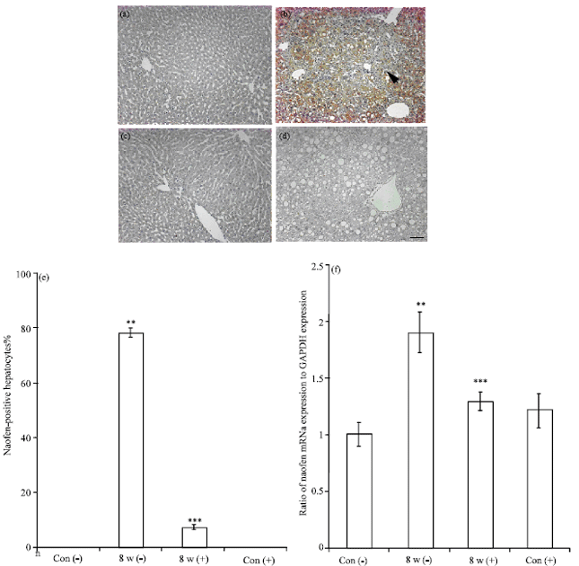 Image for - Effects of 1-O-hexyl-2, 3, 5-trimethylhydroquinone in Carbon Tetrachloride-induced Hepatic Apoptosis with a Possible Relationship to Naofen