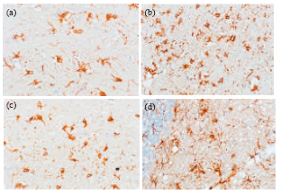 Image for - Effects of Acute Hyperglycemia on Blood Brain Barrier During Pentylenetetrazole-induced Epileptic Seizures