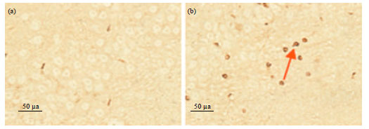 Image for - The Relationship Between the Expression of CIDE-B and the Neuronal Apoptosis Following Cerebral Ischemia Reperfusion in Rats