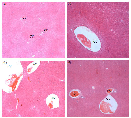 Image for - Subacute Toxic Effects of Melastoma malabathricum Linn. Aqueous Leaf Extract  on Liver and Kidney Histopathology of Rats