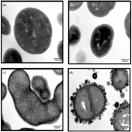 Image for - Electron Microscope Study of Gall Extract from Quercus infectoria in  Combination with Vancomycin against MRSA Using Post-Antibiotic Effect Determination