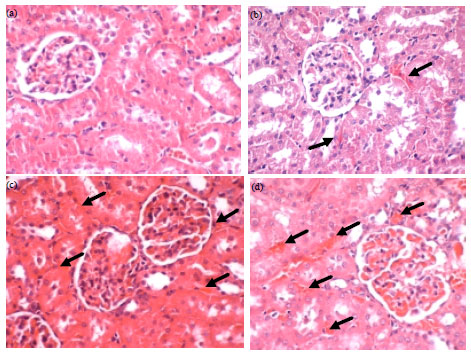 Image for - Subacute Toxic Effects of Melastoma malabathricum Linn. Aqueous Leaf Extract  on Liver and Kidney Histopathology of Rats