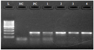 Image for - Strain Typing and Strain Differentiation of Mycobacterium leprae by TTC Repeats