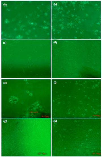 Image for - Evaluation of in vitro Efficacy of Vitamin D3 on the Osteogenic Differentiation and Mineralization Capabilities of Fetal and Adult Osteoblasts of Rabbit Reflects Therapeutic Potential