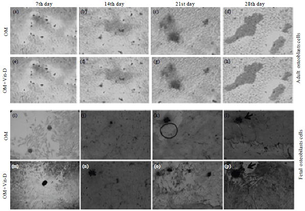 Image for - Evaluation of in vitro Efficacy of Vitamin D3 on the Osteogenic Differentiation and Mineralization Capabilities of Fetal and Adult Osteoblasts of Rabbit Reflects Therapeutic Potential