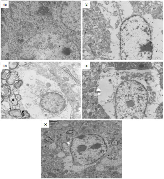 Image for - Chrysophanol Liposome Preconditioning Protects against Cerebral Ischemia-reperfusion  Injury by Inhibiting Oxidative Stress and Apoptosis in Mice