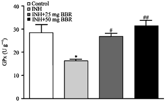 Image for - Berberine Attenuates Isoniazid-Induced Hepatotoxicity by Modulating Peroxisome Proliferator-Activated Receptor γ, Oxidative Stress and Inflammation