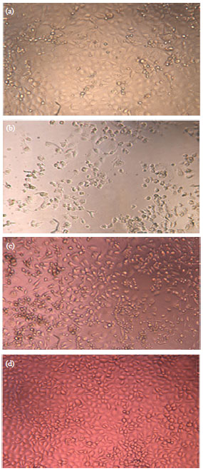 Image for - Inhibition of Porcine Reproductive and Respiratory Syndrome Virus in vitro By Forsythoside A