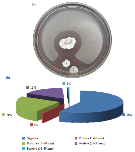 Image for - Isolation, Screening and Identification of Actinobacteria with Uricase Activity: Statistical Optimization of Fermentation Conditions for Improved Production of Uricase by Streptomyces rochei NEAE-25