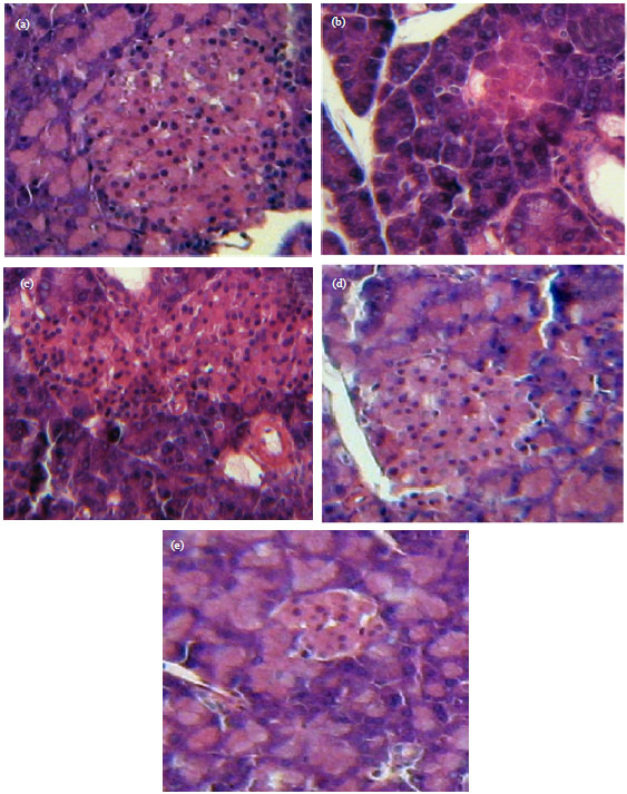 Image for - Antidiabetic and Hypolipidemic Potential of 3, 4-dihydroisoquinolin-2(1H)- Sulfonamide in Alloxan Induced Diabetic Rats