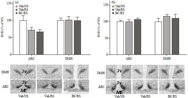 Image for - Bicuculline Ameliorated Chronic, but not Acute, Stress-Induced Feeding Suppression