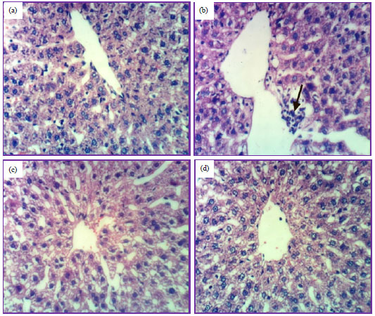 Image for - Antihyperglycemic and Antihyperlipidemic Effects of Ferula duranii in Experimental Type 2 Diabetic Rats