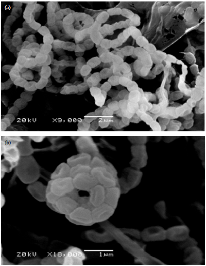 Image for - Isolation, Screening and Identification of Actinobacteria with Uricase Activity: Statistical Optimization of Fermentation Conditions for Improved Production of Uricase by Streptomyces rochei NEAE-25
