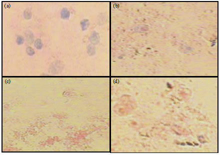 Image for - Cytotoxicity, DNA Fragmentation and Histological Analysis of MCF-7 Cells Treated with Acetylspermine