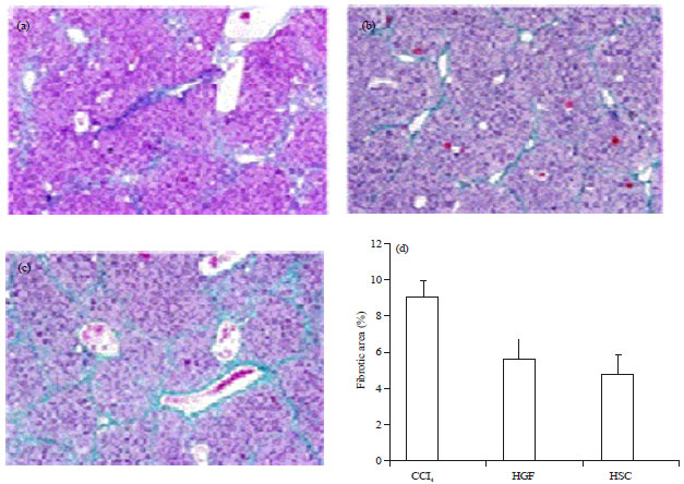 Image for - Therapeutic Effects of CD133+ in the Carbon Tetrachloride (CCl4) Induced Chronic Liver Dysfunction in Rat Model