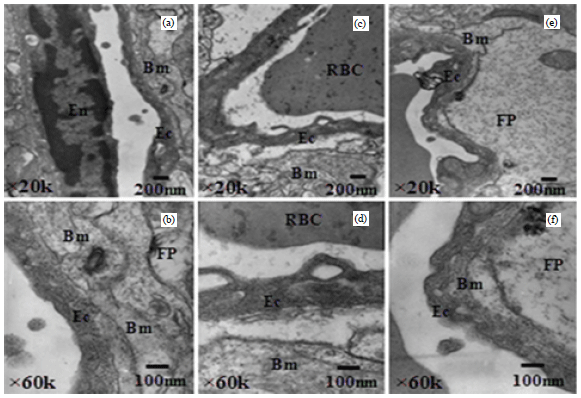 Image for - Improvement in the Ultrastructures of Nervous Tissues Damaged in Cerebral Ischemic  Rate by Picroside II