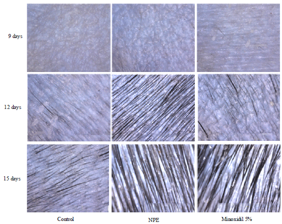 Image for - Action Mechanism of Natural Plant Extracts for Hair Loss Prevention and Hair Growth Promotion in C57BL/6 Mice