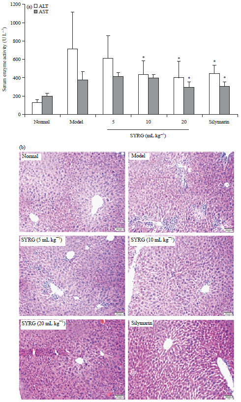 Image for - A Traditional Chinese Medicine Shaoyao Ruangan HejiAmeliorates Carbon Tetrachloride-induced Liver Injury ThroughMultiple Stress and Toxicity Pathways