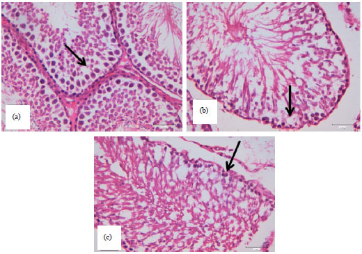 Image for - Effect of Aflatoxin B1 on Histopathology and Oxidative Stress Biomarkers in Testis of Rats with Special References to Gene Expression of Antioxidant Enzymes
