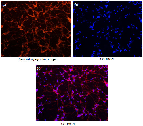 Image for - Estrogen-like Properties of Quercetin Protect Rat Hippocampal Neurons by Estrogen Receptor Alpha