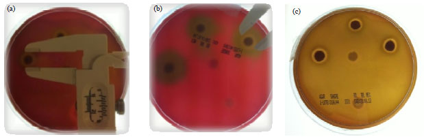 Image for - Antimicrobial Effect of the Methanolic Extract Psacalium decompositum on Periodontopathogenic Bacteria