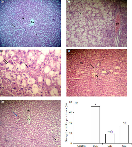 Image for - Cinnamaldehyde Mitigates Carbon Tetrachloride-induced Acute Liver Injury in Rats Through Inhibition of Toll-like Receptor 4 Signaling Pathway