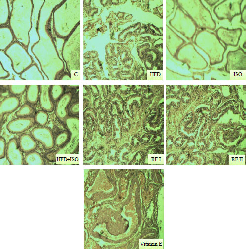 Image for - Therapeutic Potential of Polyherbal Formulation Against Experimentally Induced Insulin Resistant Myocardial Infarction in Rats