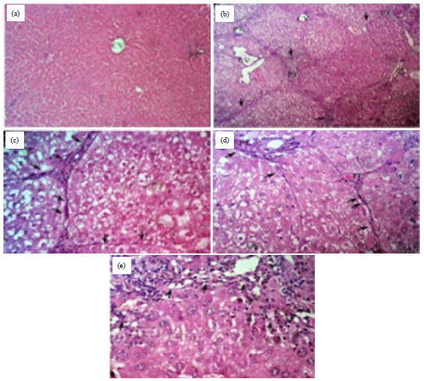 Image for - Protective Effects of Curcumin and Ginger on Liver Cirrhosis Induced by Carbon Tetrachloride in Rats
