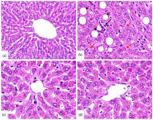 Image for - Diosmin Protects Against Cyclophosphamide-induced Liver Injury Through Attenuation of Oxidative Stress, Inflammation and Apoptosis