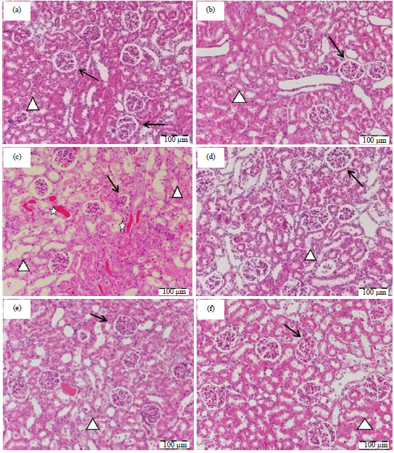 Image for - Anti-apoptotic and Anti-inflammatory Effects of Olive Leaf Extract Against Cisplatin-induced Nephrotoxicity in Male Rats