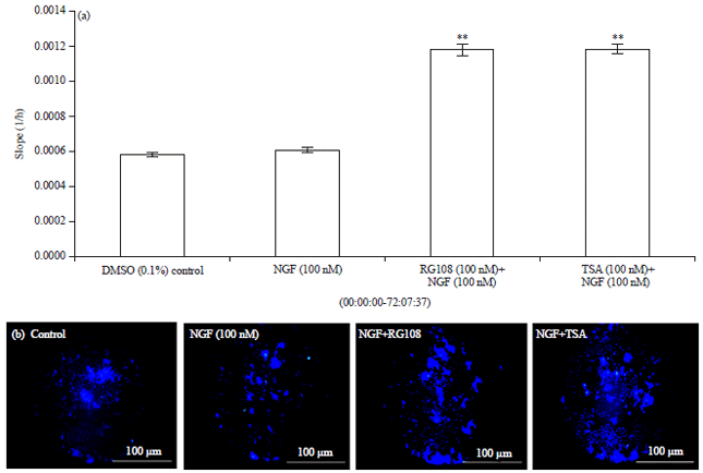 Image for - Effects of DNMT and HDAC Inhibitors (RG108 and Trichostatin A) on NGF-induced Neurite Outgrowth and Cellular Migration
