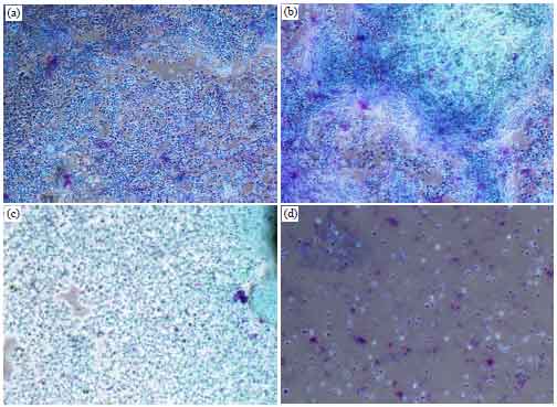 Image for - Cytotoxic and Anti-proliferative Activities of the Tetrapleura tetraptera Fruit Extract on Ehrlich Ascites Tumor Cells