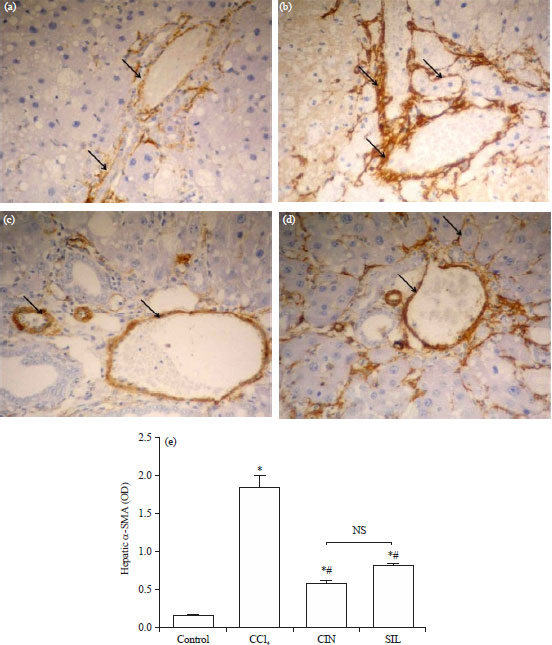 Image for - Cinnamaldehyde Mitigates Carbon Tetrachloride-induced Acute Liver Injury in Rats Through Inhibition of Toll-like Receptor 4 Signaling Pathway
