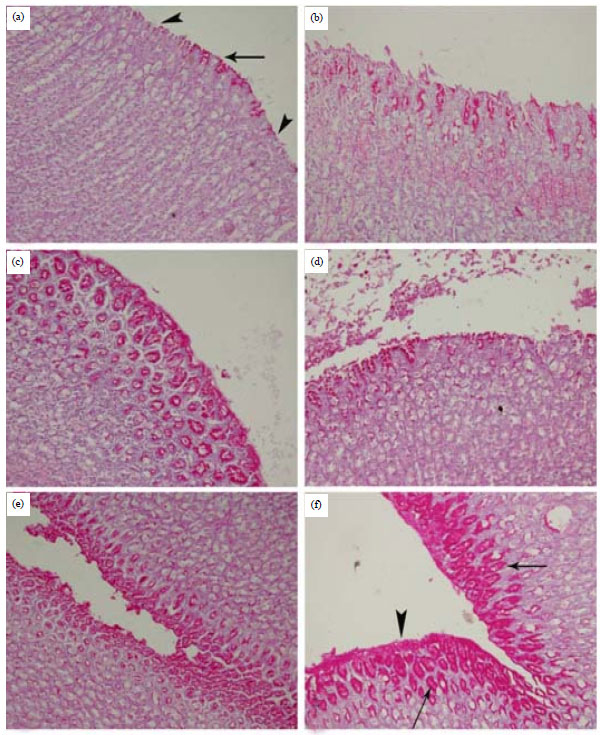 Image for - Study of the Protective Effects of Flaxseed Oil on Ethanol Induced Gastric Mucosal Lesions in Non Ovariectomized and Ovariectomized Rats
