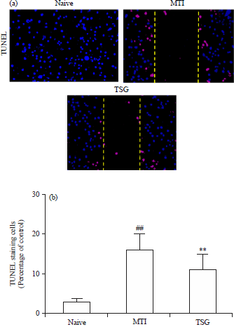 Image for - Neuroprotection of TSG Against Mechanical Trauma Injury Through an Anti-inflammatory Mechanism in Human Neuroblastoma SH-SY5Y Cells