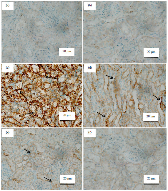 Image for - Anti-apoptotic and Anti-inflammatory Effects of Olive Leaf Extract Against Cisplatin-induced Nephrotoxicity in Male Rats