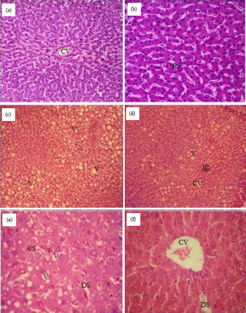 Image for - Anti-obesity and Anti-hepatosteatosis Effects of Dietary Zingiber officinale Extract in Male Obese Rats