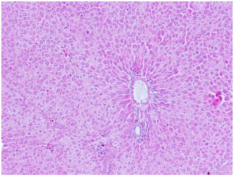 Image for - Histopathological Changes Induced by Artesunate in Liver of Wistar Rat