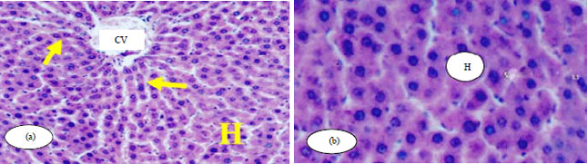 Image for - Hepatoprotective Effect of Rutin Against Oxidative Stress of Isoniazid in Albino Rats