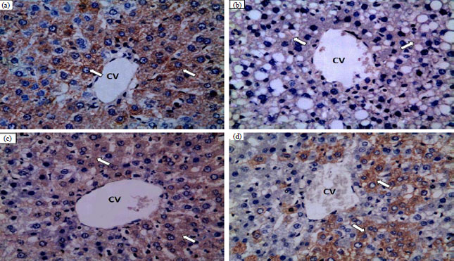 Image for - Hepatoprotective Effect of Diosmin on Iron-induced Liver Damage
