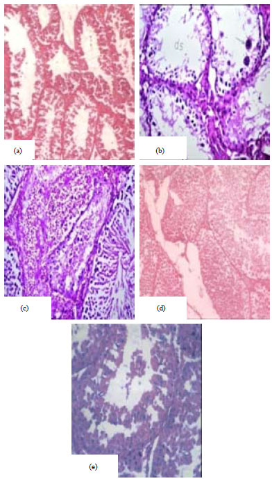 Image for - Protective Effect of Vitazinc on Chlorsan Induced Oxidative Stress, Genotoxicity and Histopathological Changes in Testicular Tissues of Male Rats