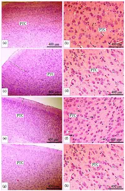 Image for - Green Tea Protects Against Perinatal Nicotine-induced Histological, Biochemical and Hematological Alterations in Mice Offspring