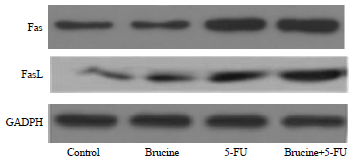 Image for - Brucine Sensitizes HepG2 Human Liver Cancer Cells to 5-fluorouracil via Fas/FasL Apoptotic Pathway